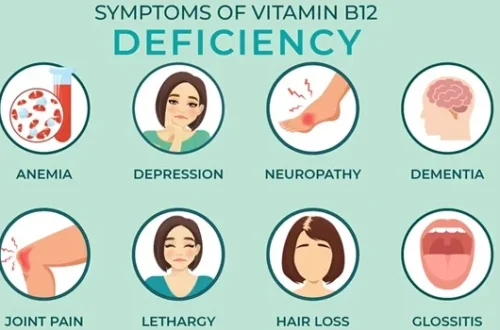 Vitamin B12 Deficiency